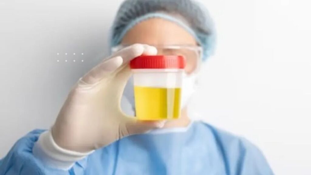 Urine में जलन के कारण, Best घरेलू उपचार और बचाव के तरीके 2025