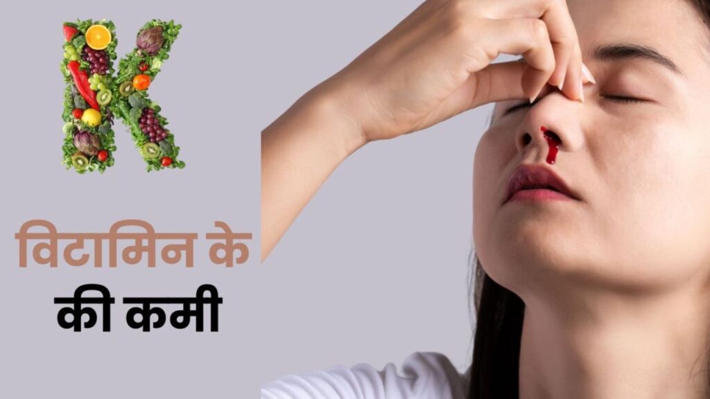 Vitamins की कमी से होने वाला पैर दर्द: लक्षण, वजहें और Best उपचार 2025